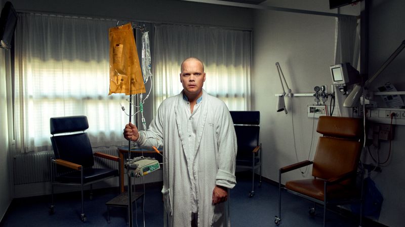 Chemo Brain